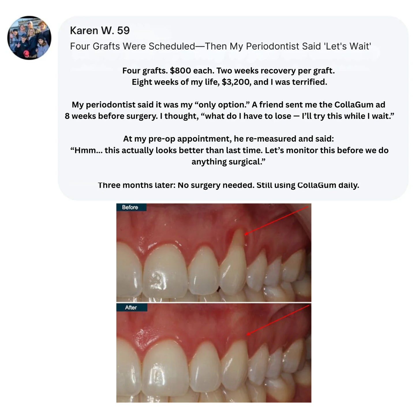 CURO™ CollaGum™ Strengthens gums & enamel