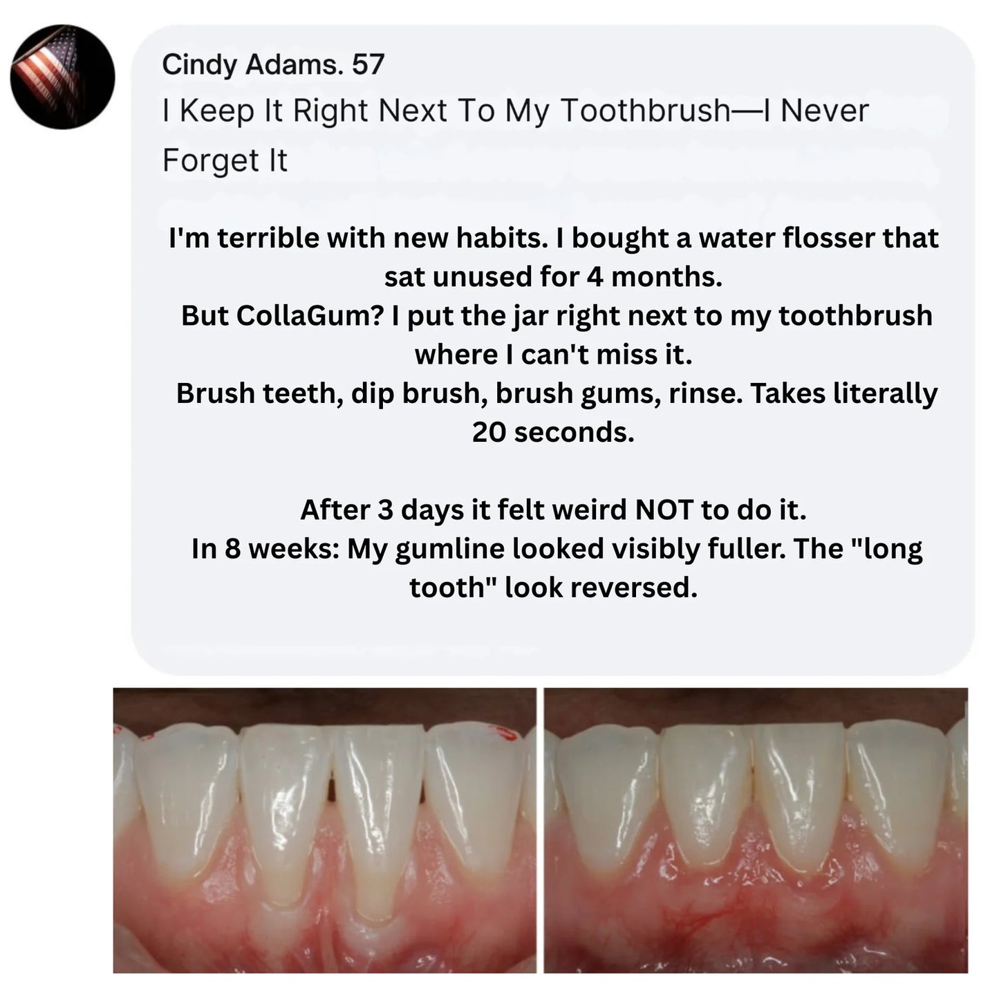 CURO™ CollaGum™ Strengthens gums & enamel