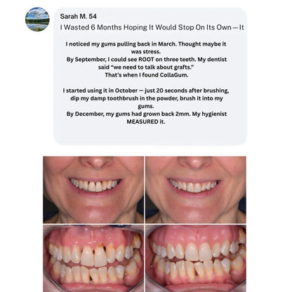 CURO™ CollaGum™ Strengthens gums & enamel