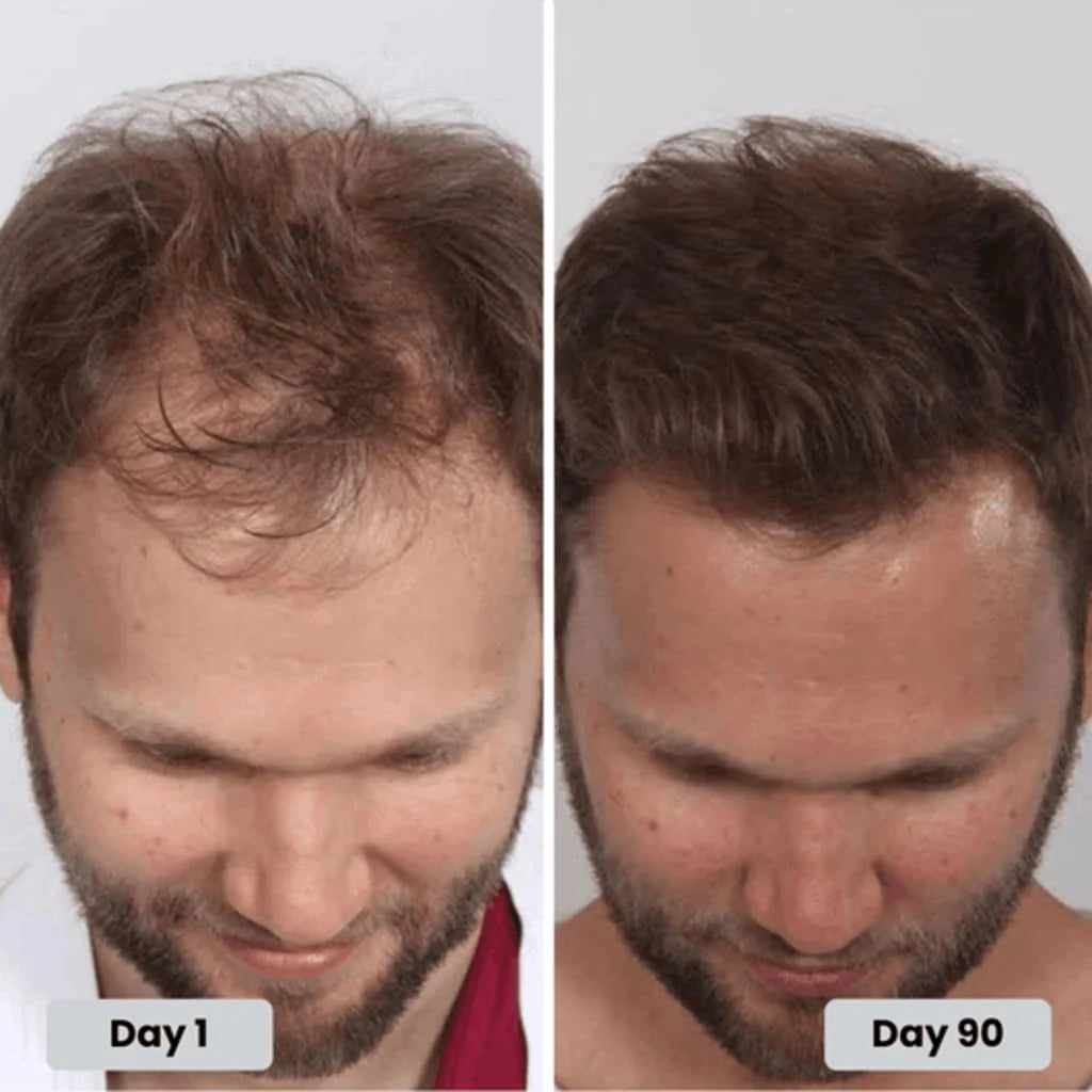 CURO™ The Hair-Restoring Red Light Hat